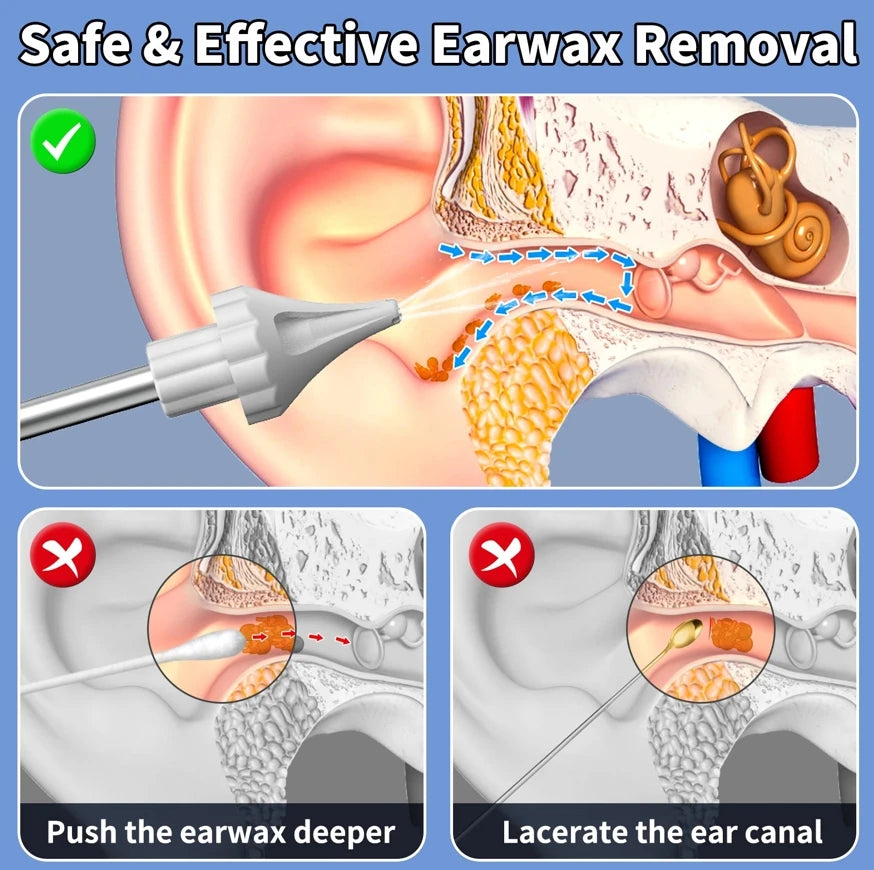 2025 Hot Sale New Products Electronic Ear Cleaner Tool Ear Wax Remover Wax Ear Cleaner Consumer Electronics